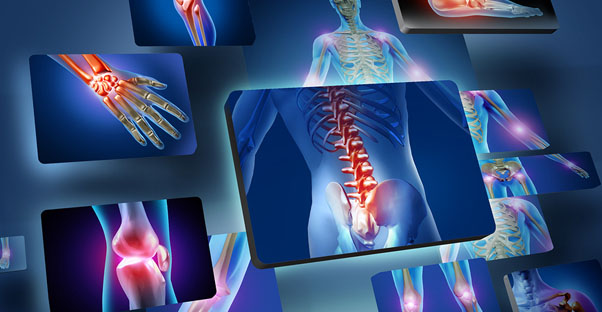 a rheumatoid arthritis x-ray shows problem points