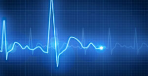 a heart rate monitor shows signs of high blood pressure in a patient