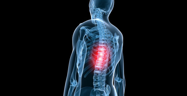 an x-ray shows back pain pressure points