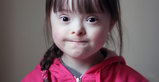 A child with Down syndrome