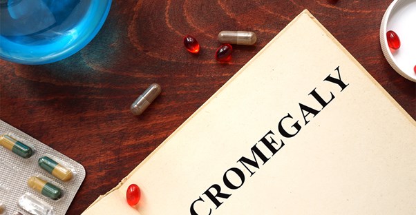 An acromegaly textbook