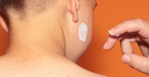 A child has its chickenpox treated
