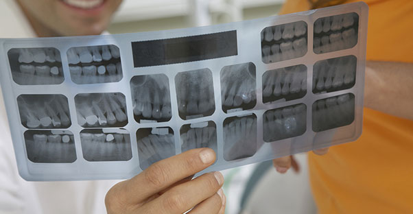 Patient reading to understand his medicaid dental coverage