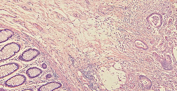 Colon imaging