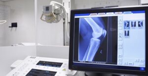 A computerized X-ray