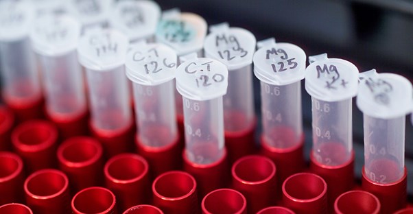 Some blood samples