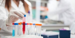 Specialists in a blood testing lab