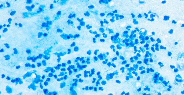 A blood test