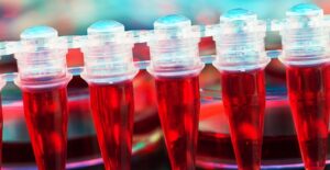 Vials of blood