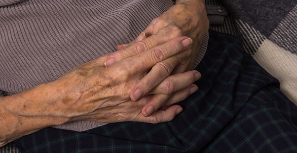 Liver spots being caused