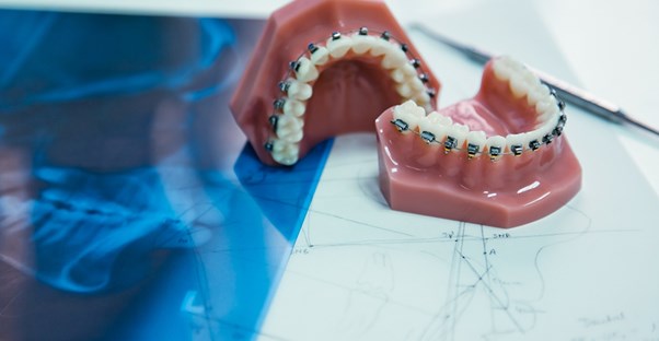 A set of dentures