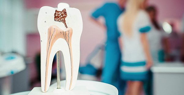 A model of a tooth