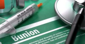 Some bunion information