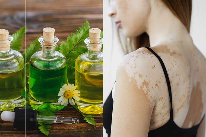 Fern Extract