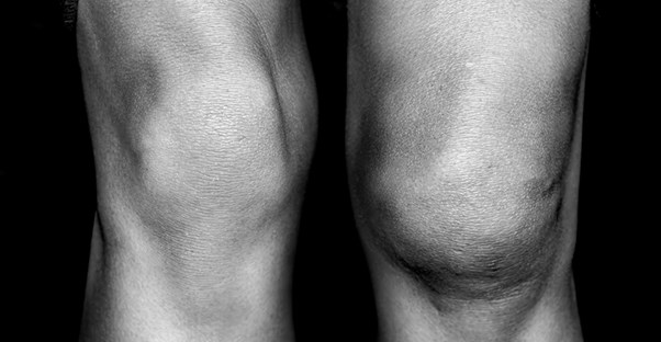 A nice pair of knees