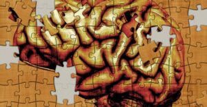 A schizoaffective brain