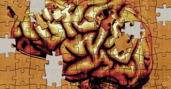 A schizoaffective brain