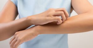 Woman itching contact dermatitis