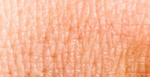 skin dermatitis