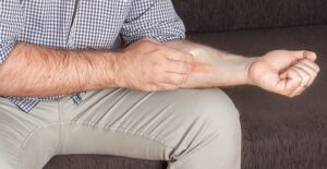 Dermatitis on arm