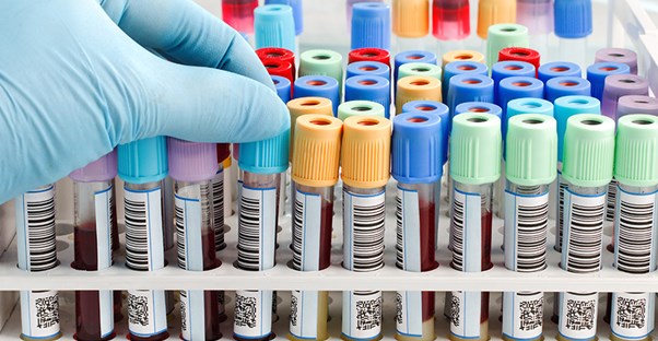 testing cirrhosis stages
