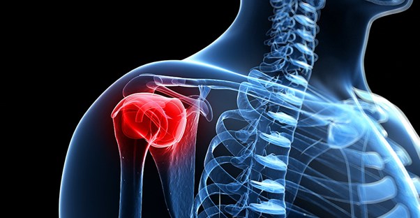 rotator cuff surgery