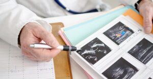 diagnosing spina bifida