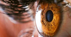 legal blindness