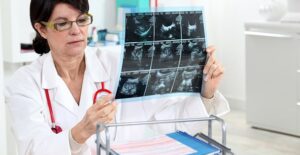 doctor examining an xray for symptoms of myofascial pain syndrome