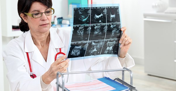 doctor examining an xray for symptoms of myofascial pain syndrome