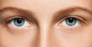 person with a healed eye from recently receiving stye treatments