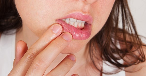 girl with symptoms of chapped lips