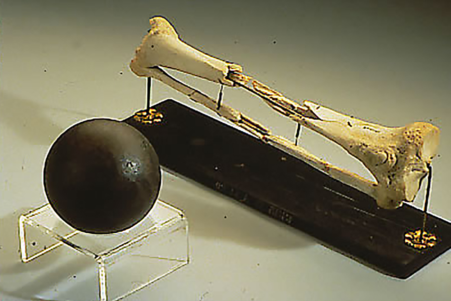 Dan Sickles' Leg