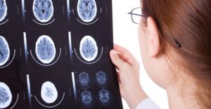 Doctor looking at brain scans. Traumatic brain injuries.