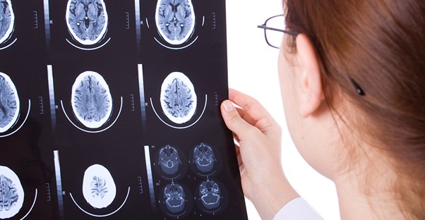Doctor looking at brain scans. Traumatic brain injuries.
