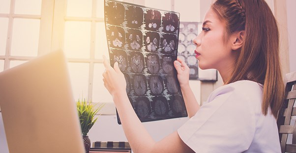 Doctor looking at brain scans. Traumatic brain injury treatment.