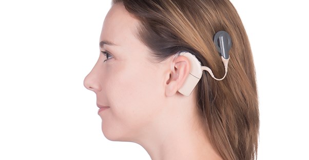 cochlear implant