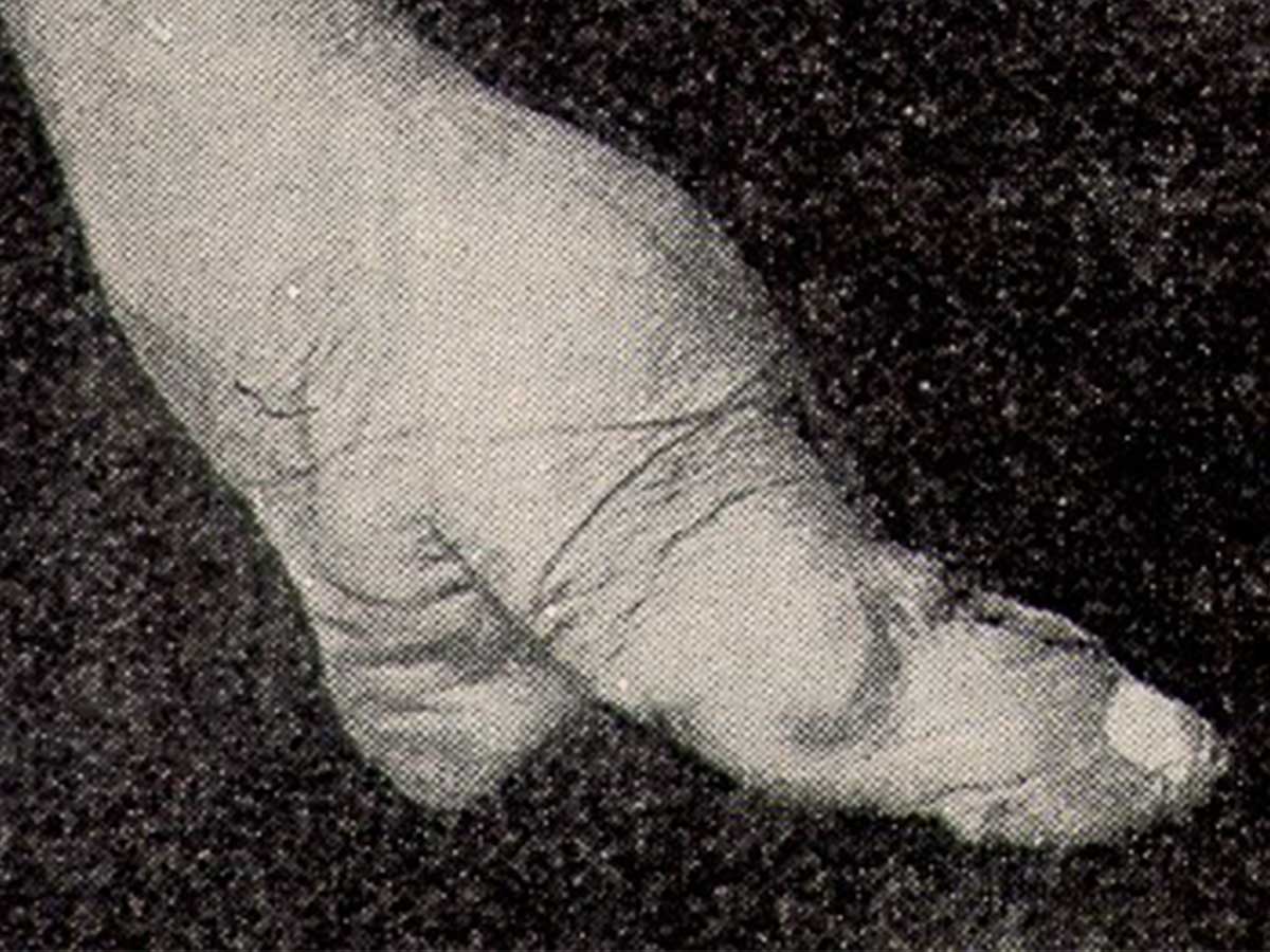 Foot Binding