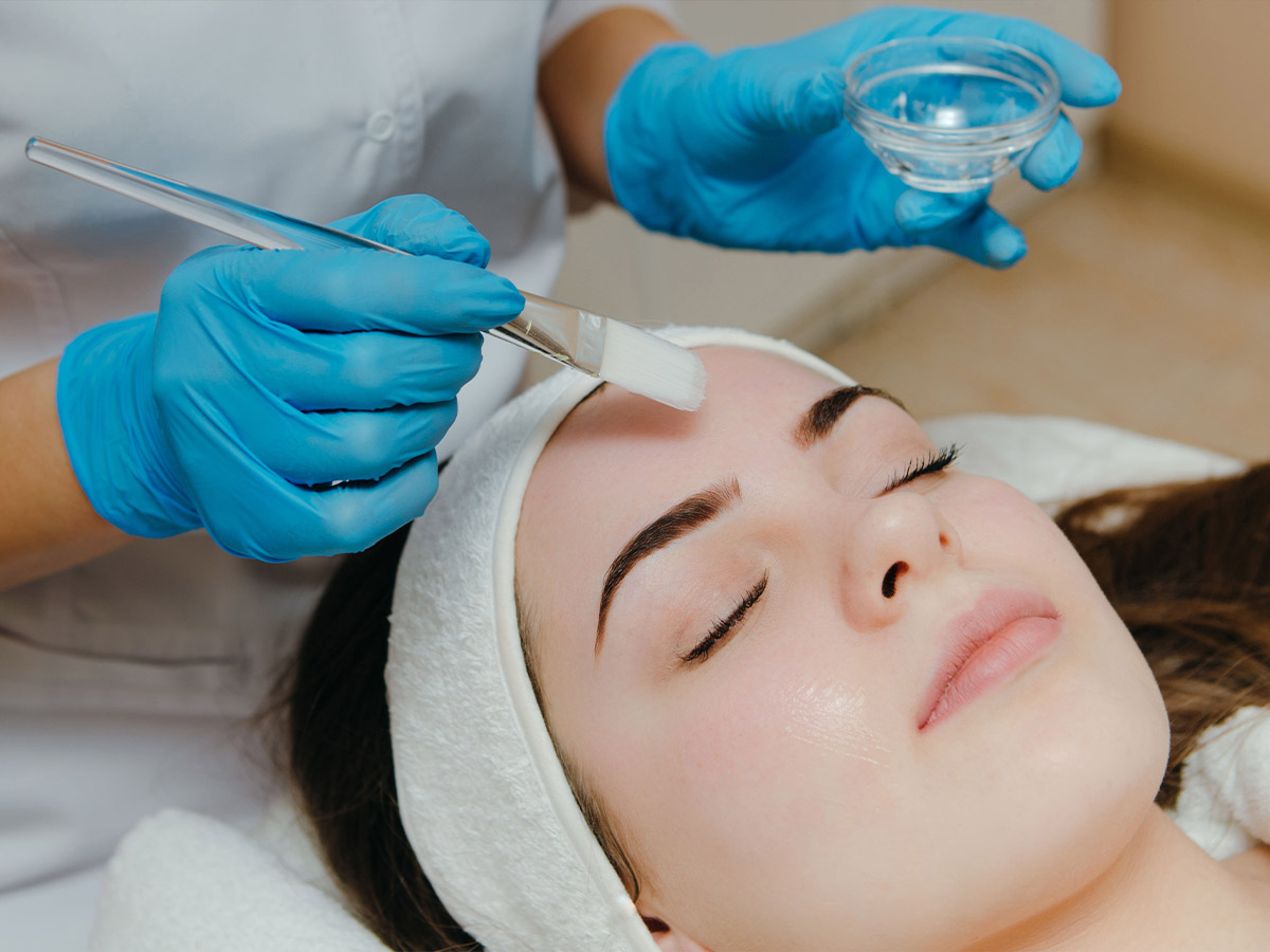 Get an Acid Peel