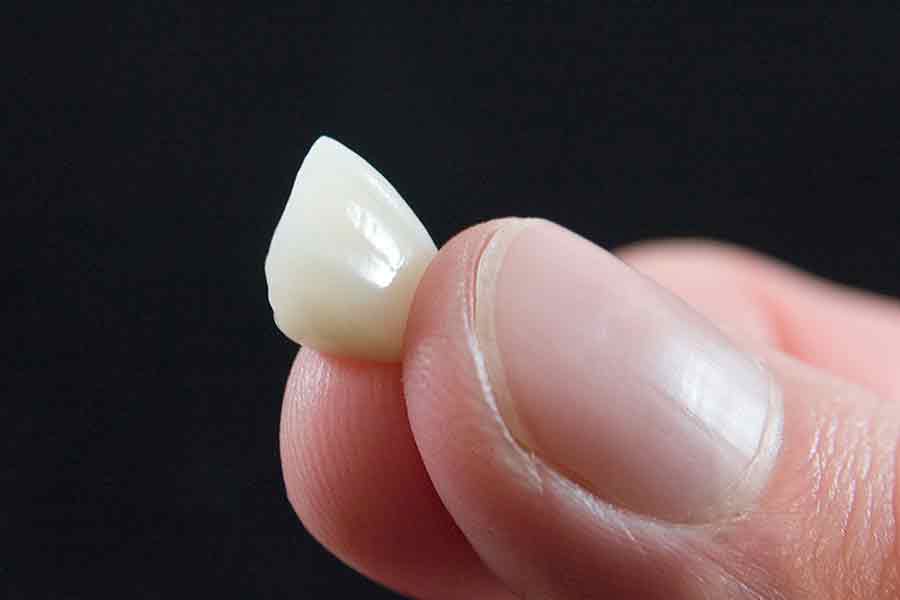 Losing Your Teeth