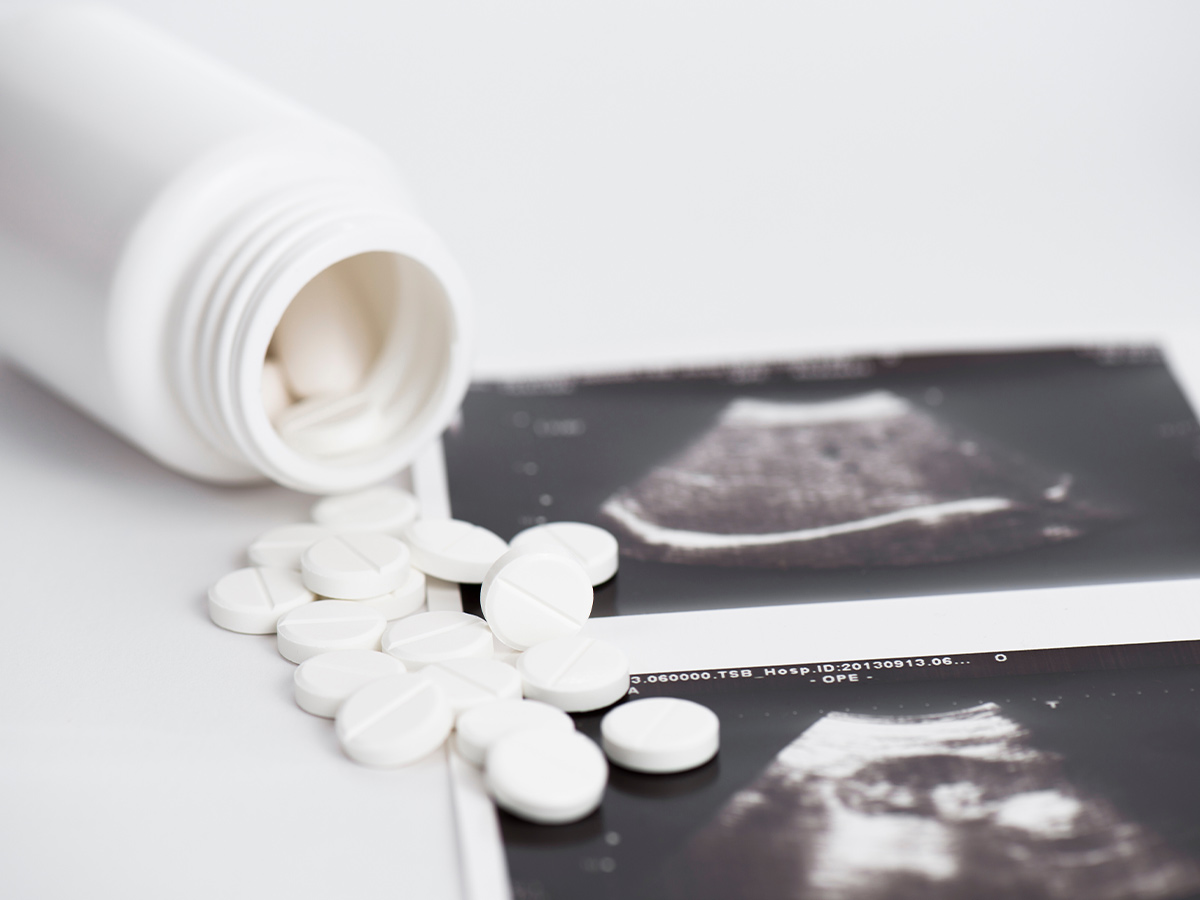 Abortion