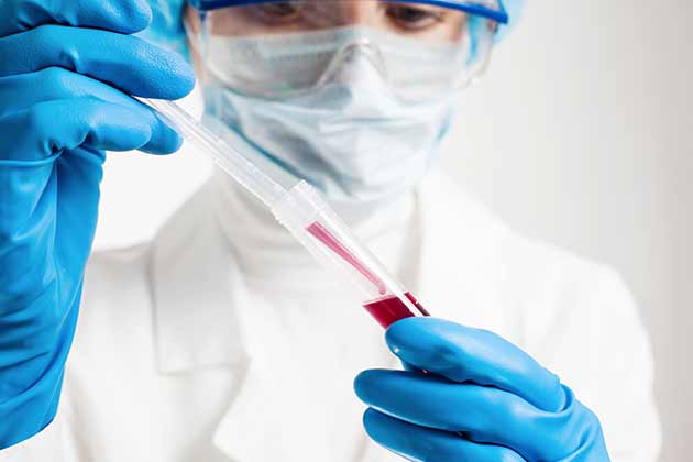 Prevent Blood Clots