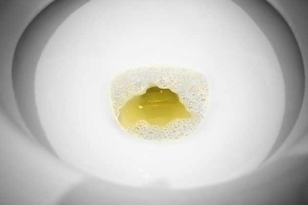 Your Urine is Yellow