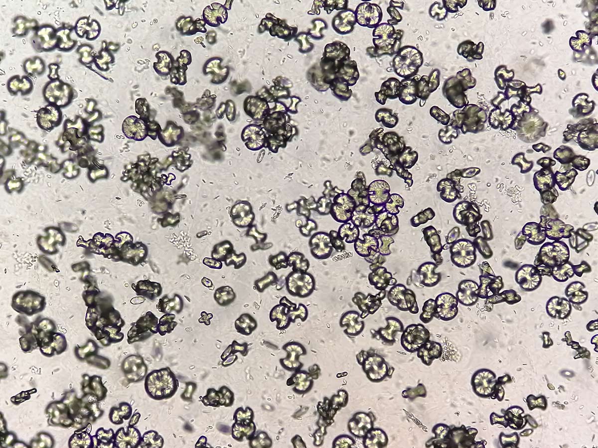Term to Know: Uric Acid