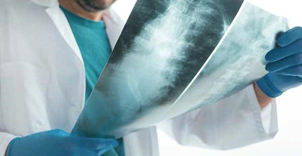 5 Reasons You're Having Back and Neck Pain (and 12 Ways to Treat It)