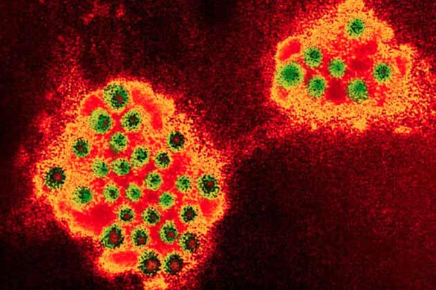 Norovirus