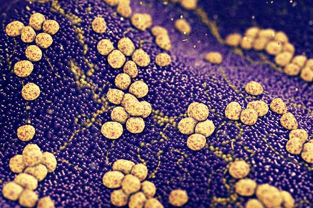 Staphylococcal