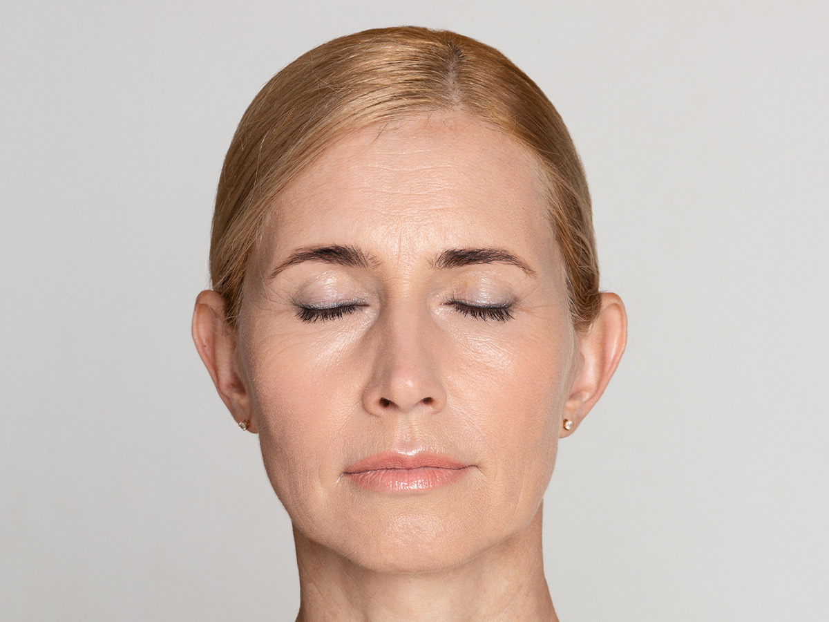 Prime Your Lids if You Have Visible Veins or Spots