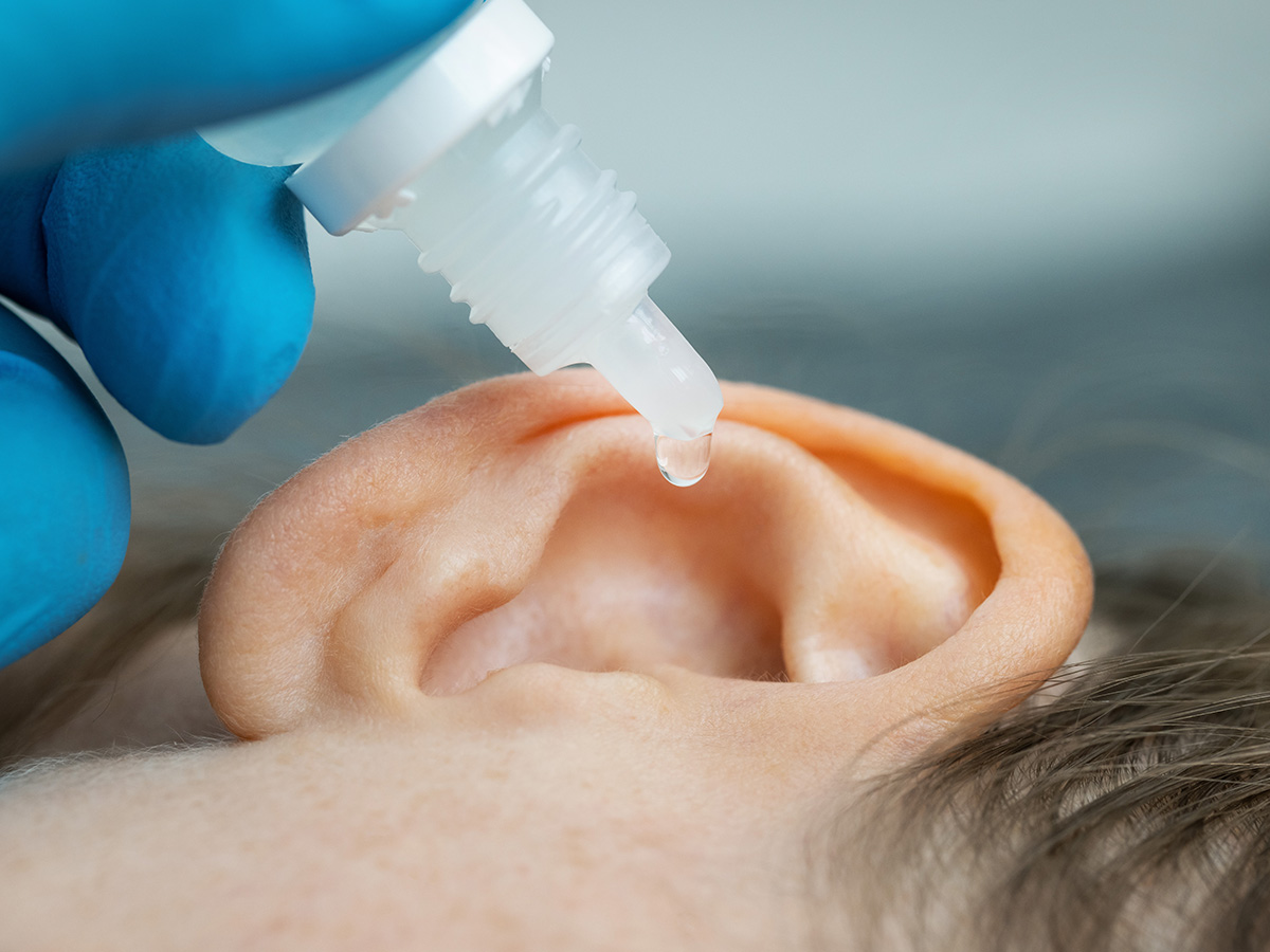 Vinegar and Rubbing Alcohol for Swimmer’s Ear