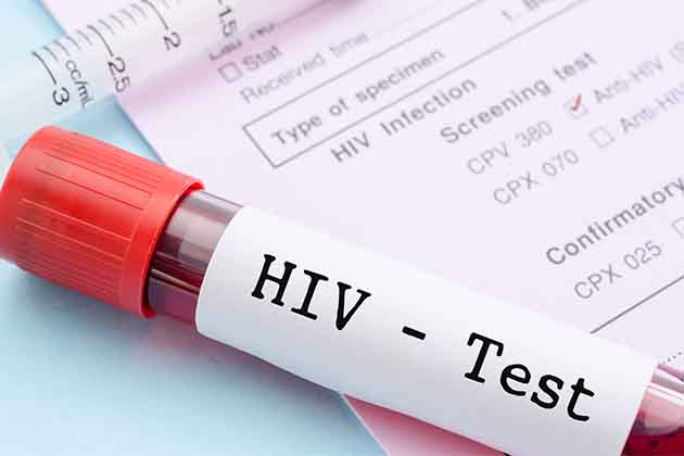 STI Screening
